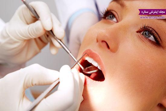 لمینت دندان چیست و چه تفاوتی با ایمپلنت دارد؟