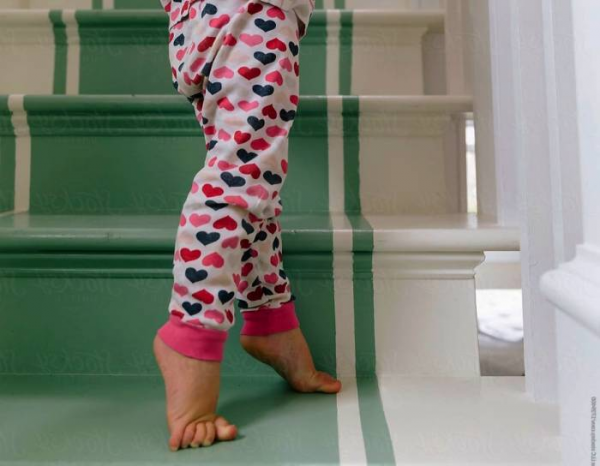 علت و علامت خطرناک راه رفتن کودک روی پنجه پا